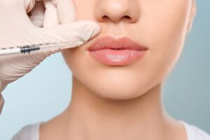 Woman getting dermal fillers in her lips