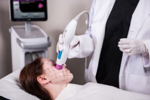 Thermage FLX™ Procedure 1 1024x683 1