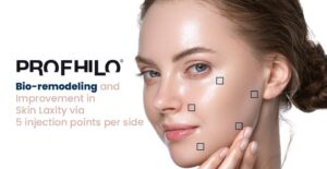profhilo singapore ageless medical